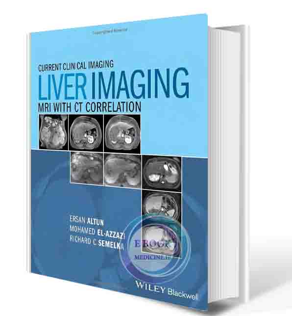 دانلود کتابLiver Imaging: MRI with CT Correlation (Current Clinical Imaging) 1st (ORIGINAL PDF)